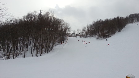 20170304_093554
